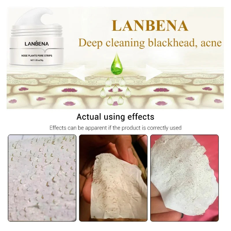 LANBENA Blackhead Remover Mask